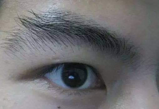 眉壓眼